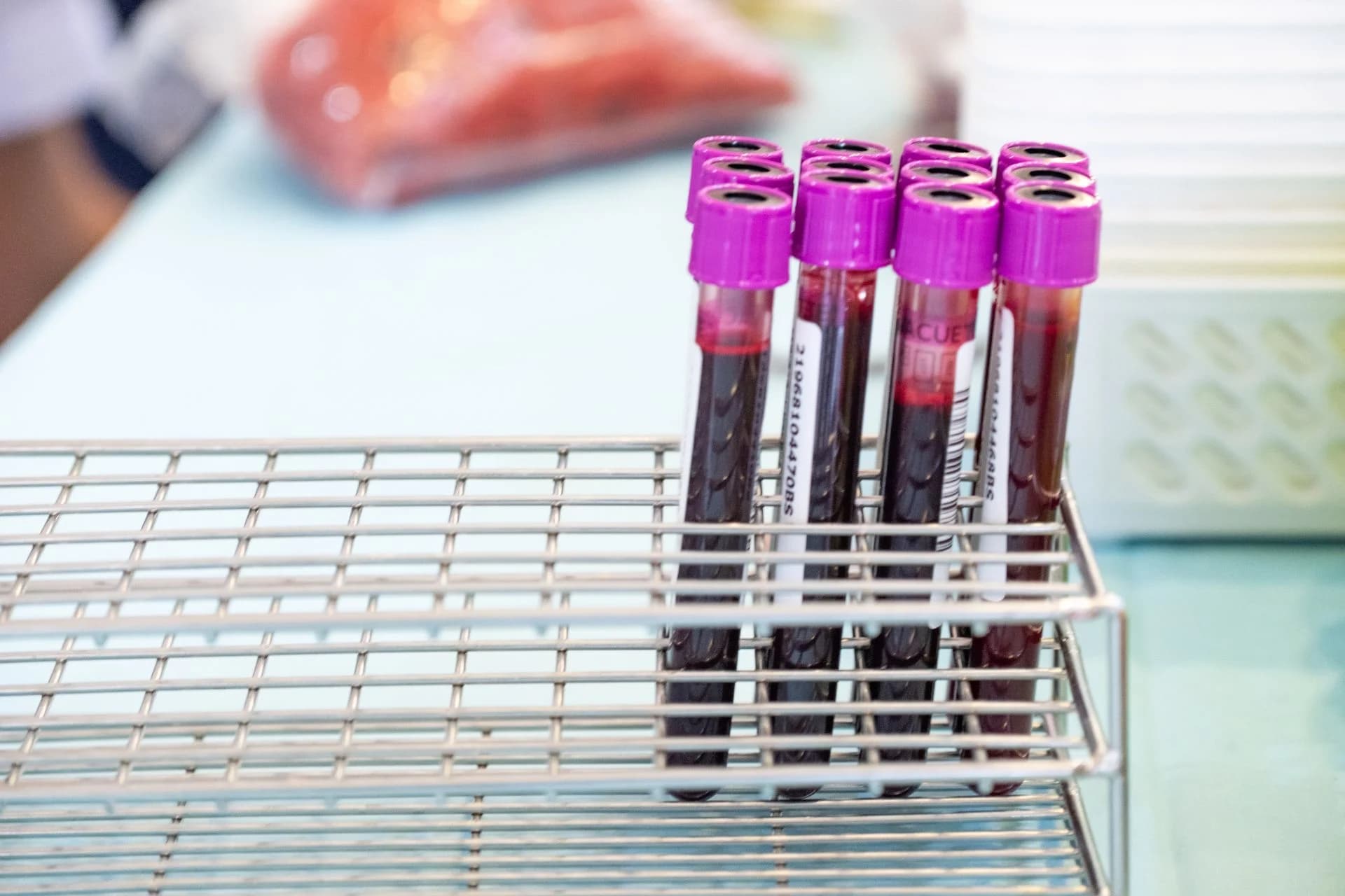 Alzheimer’s Prediction Tool: Blood Test Estimates Symptom Onset Within 3–4 Years